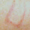 3-sided Rectangle